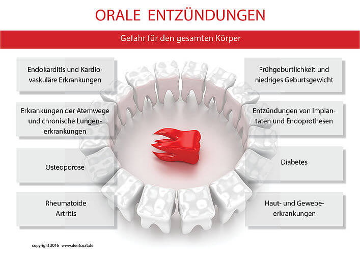 Bioaktiver Zahnschutz